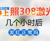 308激光和种植黑色素哪个抗复发的效果好”