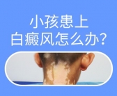 身上出现白斑怎么治不复发”