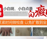 手上起小白斑怎么能治好”