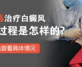 手上皮肤有白块需要检查吗