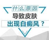探究：308nm一般需要照几次白癜风就可以好”