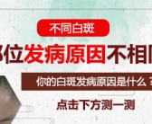 白癜风不扩散吃什么药效果才好”