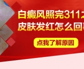 手上起小白斑图片怎么能治好
