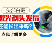 白癜风两年稳定期种植黑色素怎么样”