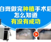 小块白癜风吃什么药能快速治好”