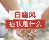 白癜风刚发病没多久怎么治疗好的快”