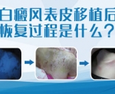 孩子手上长小白斑图片什么原因引起的”