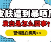 手上起白斑图片需要用药吗”