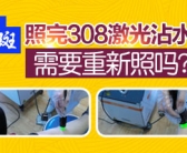 小块白癜风选择哪个方法好的快”