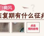 白癜风面积不是很多选择哪个方法有效果”