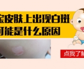 小孩子手上长白斑需要用药吗