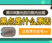 2022年治疗白癜风能治好吗”