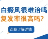目前治疗白癜风用不用治”