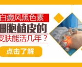 小孩有白癜风照射308激光间隔多长时间照一次好”