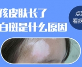 小孩脸上出现一小块块的白皮肤怎么回事”