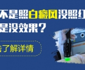 手上长小白斑图片是缺什么维生素吗