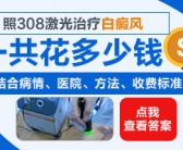 儿童白癜风照308激光一个月照射几次”