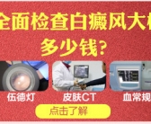手上有白斑图片要检查什么”