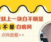 黑色素种植技术治疗白癜风做几次能好”