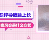 手上有白斑是什么原因”