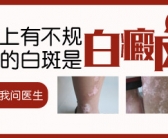 手上长小白斑图片需要用药吗”