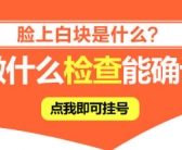 脸上长白癜风治好的希望大吗”