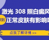 现在治疗白癜风目前能治好吗”