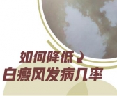 五岁孩子脸上为什么长小白斑要不要紧”