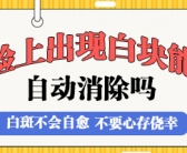 手上长了好多小白斑是皮肤病吗
