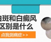 手上出小白斑需要检查吗”