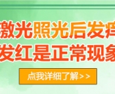 一块白斑照几次308激光能照好”