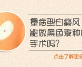 用黑色素种植治好白癜风的希望大吗”