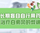 胳膊白癜风一周照几次308好得快”