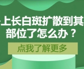 小孩脸上起小白斑要怎么才能祛除”