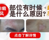 头上手上有小白斑会是什么皮肤病”