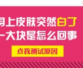 手上白斑怎么办会是什么皮肤病