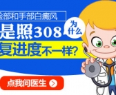 手腕指甲盖大白癜风能不能治好”