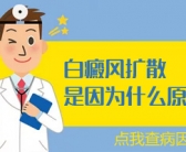长在脸上的白癜风怎么控制”