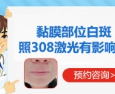 局限型白癜风有没有好的药方”