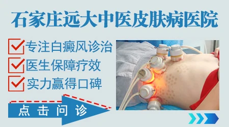 孩子胳膊上有两块白块怎么回事？别急，这里有答案！”