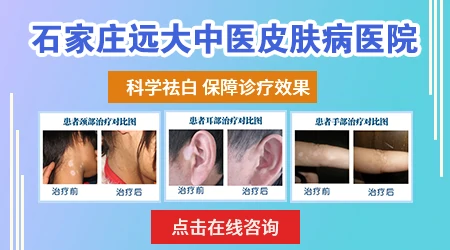 探究孕妇白癜风进行308激光照射后,会有副作用吗?