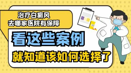 医院如何快速有效治疗小儿白癜风?