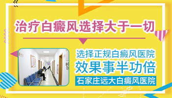 宝宝患上白癜风，家长应该如何应对？”