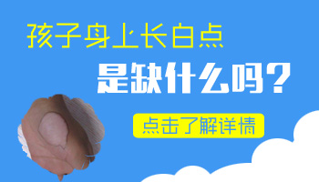 男性白癜风怎么做治疗的好