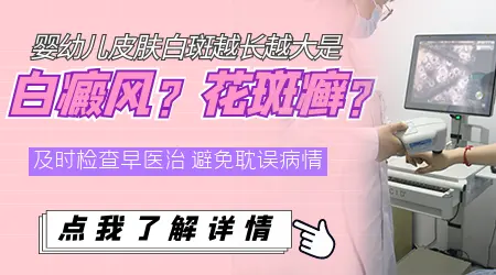 探索中医智慧：有效调理白癜风的传统药方