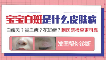 男性白癜风患者夏季饮酒的危害详解