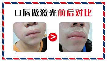 孩子手掌上的小白点，究竟是何方神圣？”