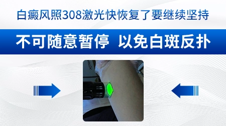 小孩儿的白癜风如何护理呢?”