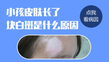 满月宝宝脸上有白块是怎么了