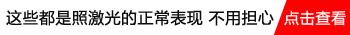 如何早期有效治疗小孩白癜风？”